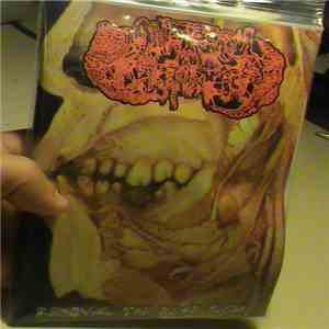 Anatomical Plastination - Removal The Dead Flesh flac download