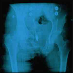 Mature Situations - Cracked Pelvis flac download