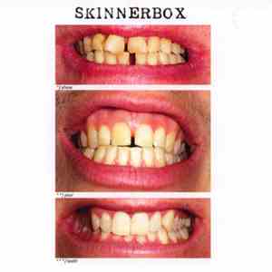 Skinnerbox  - Show Your Teeth flac download