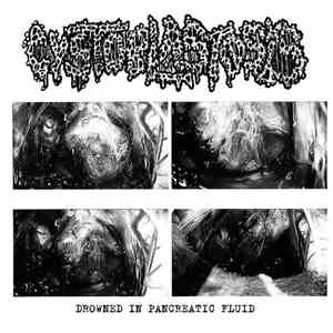 Cystoblastosis - Drowned In Pancreatic Fluid flac download
