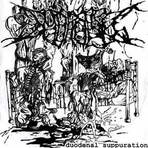 Hydropsy - Duodenal Suppuration flac download