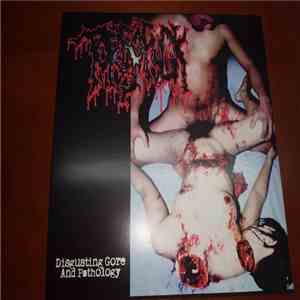 Torsofuck, Lymphatic Phlegm - Disgusting Gore And Pathology / Polymorphisms To Severe Sepsis In Trauma flac download