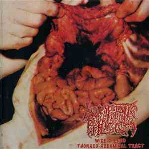Lymphatic Phlegm / Neuro-Visceral Exhumation - Wide Opened Thoraco-Abdominal Tract / Bathed In Hecatombic Concoctions flac download