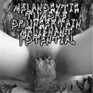 Melanocytic Tumors Of Uncertain Malignant Potential - S/t flac download