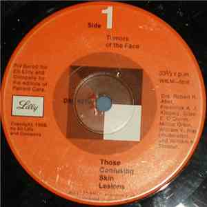 No Artist - Tumors Of The Face / Benign Lesions Of The Face flac download