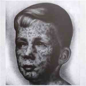 Various - Fever flac download